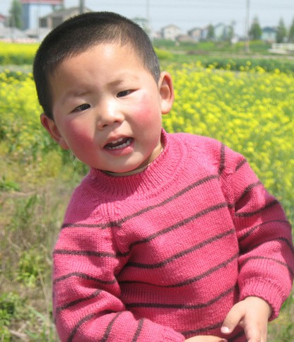 儿童癫痫 儿童癫痫病的饮食方法与护理