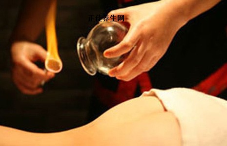 拔罐养生 拔罐带来的养生好处