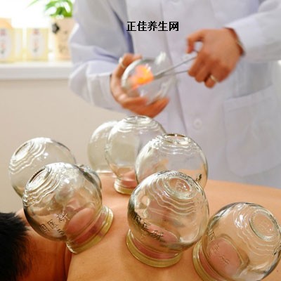 拔罐养生 拔罐带来的养生好处