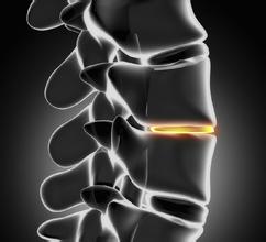 注意了 常见的这些动作会加速你的骨骼老化