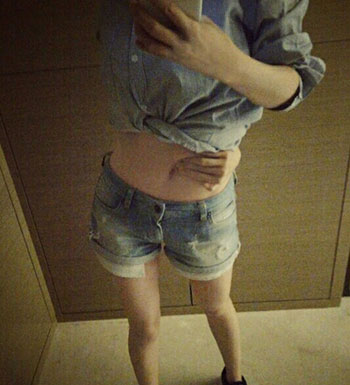 反手摸到肚脐就是好身材  过度减肥的危害