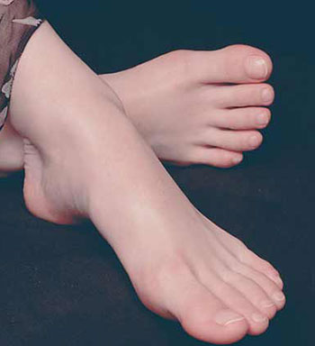 夏日保健常识 夏日怎么保护双脚远离脚气