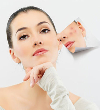 脸上为什么长痘痘 脸上长痘反映什么健康情况