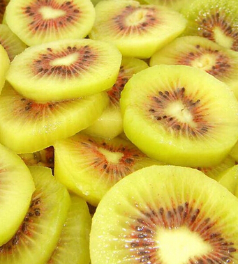 水果养生 营养猕猴桃帮你补充维生素