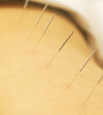 补肾的方法 帮男人改善肾虚小妙招