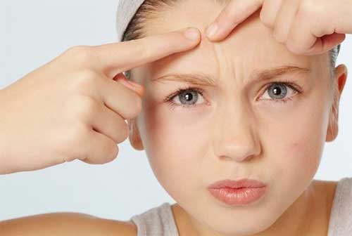 额头长痘痘怎么办，以下方法教你怎么灭痘