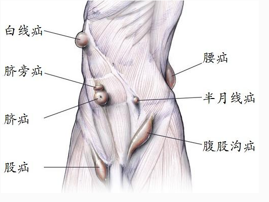 腹股沟疼痛 六种症状你要警惕