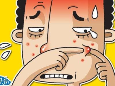 去除脸上的炸弹 治疗青春痘最好的方法