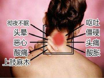 颈椎病有什么症状，这几种症状你要知道