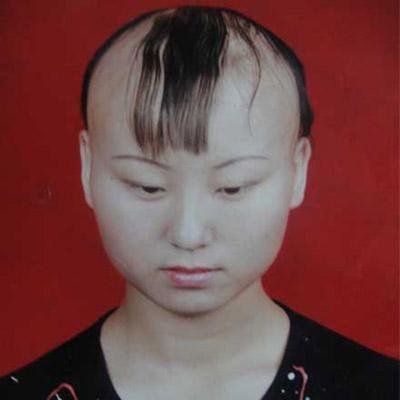 头发少怎么办  治疗脱发的偏方