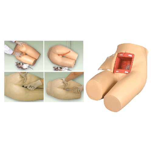 灌肠的好处和坏处及灌肠要注意的问题