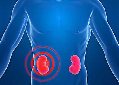 吃什么食物补肾你都知道吗