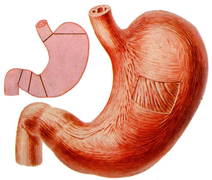 冬天吃什么养胃你知道吗