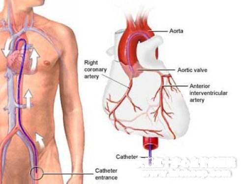 人的发动机 心脏病有哪些症状