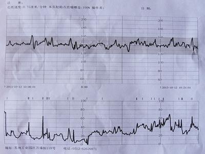 什么叫胎心监护 胎心监护的作用是什么