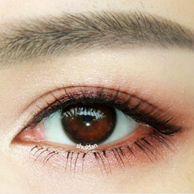 美瞳的危害  佩戴美瞳导致眼睛缺氧