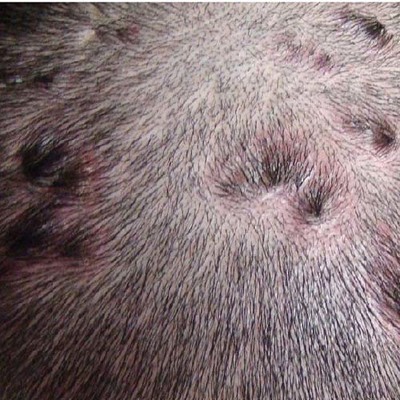 头癣的症状和局部治疗方法