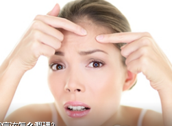额头长痘痘怎么调理 教你几招祛痘方法