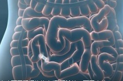 肠镜检查 六种方法你懂吗