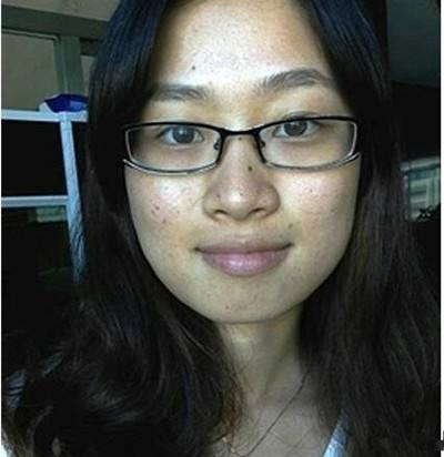 快速简单的祛痘方法 脸上长痘痘怎么快速去除