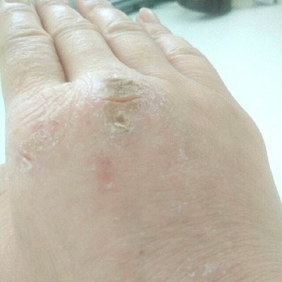 冬天皮肤瘙痒怎么办  9种方法