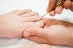 脚趾甲变厚怎么治疗 办法有3种