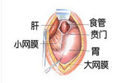 贲门疾病最常见之贲门炎