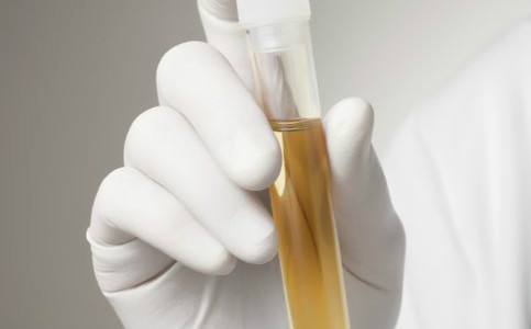 尿毒症有什么症状 这6个方面要注意