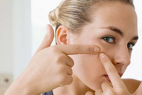 痤疮怎样治 日常护理和药物治疗方法