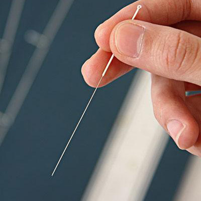 中医美容调理  中医针灸的功效