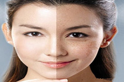 我有斗斑法宝，教你怎么自制祛斑面膜