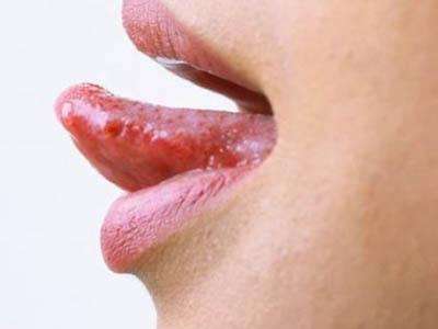 为什么会上火 教你出现上火怎么办