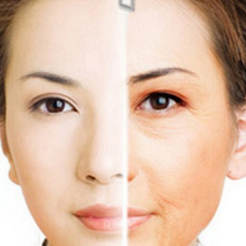 女性朋友脸部去皱纹的8个妙招