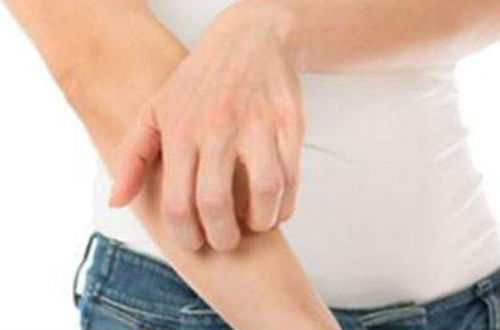 荨麻疹的症状 主要有以下六种