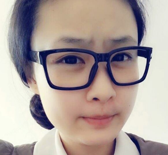 青少年近视防治需了解的几个要点