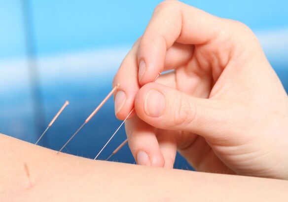 针灸减肥有副作用吗 研究表明存在副作用