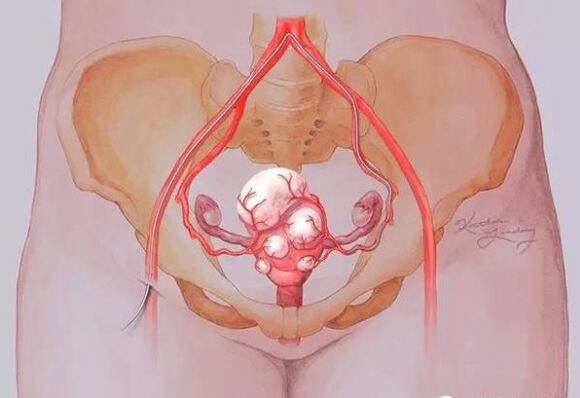 子宫保健 注意观察月经和白带是否正常