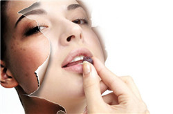 吃什么水果可以去斑 四种水果吃法