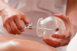 舒筋活络 拔罐子的好处介绍