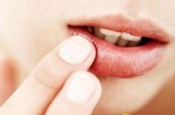 嘴上起泡怎么回事 并非上火那么简单