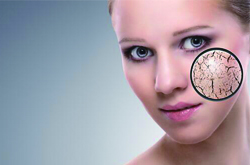 肌肤干燥怎么办 7个补水招拯救沙漠肌