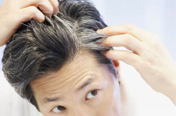 导致年轻人长白头发的三大原因介绍
