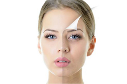 “吃走”黑斑 吃什么可以祛斑养颜