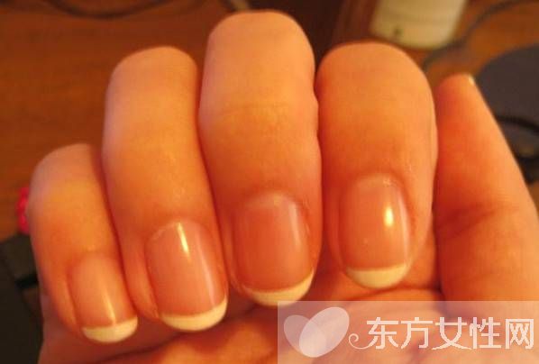 灰指甲会传染吗 灰指甲的护理方法