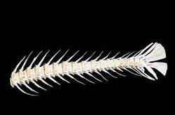 鱼刺卡住了怎么办 9种小妙招让你很快消除鱼刺