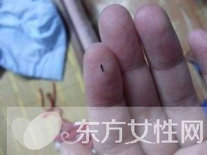 如何消灭跳蚤 消灭跳蚤的最佳办法