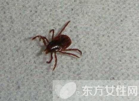 虱子咬的症状有哪些 怎样去除虱子