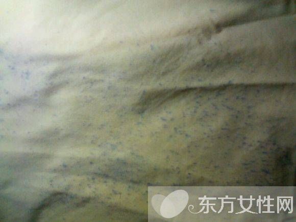 衣服发霉该如何清洗 3种简便方法一招搞定