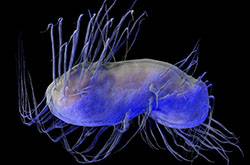 幽门螺旋杆菌感染 4大预防方法需做好