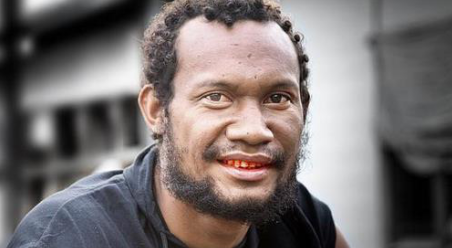 槟榔吃多了会怎么样 槟榔的危害详细介绍